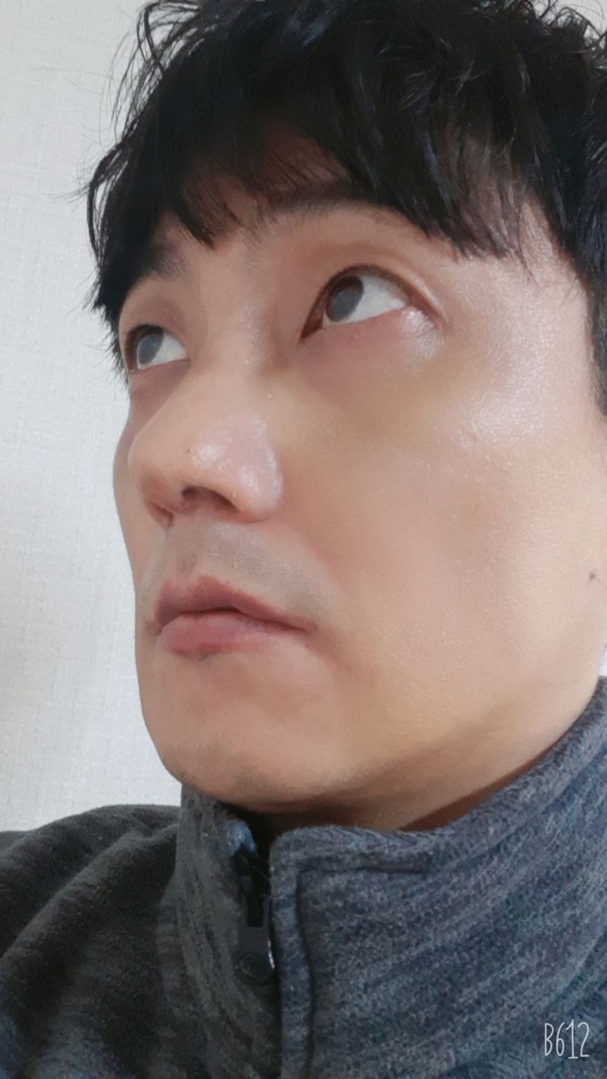 수술후기이미지