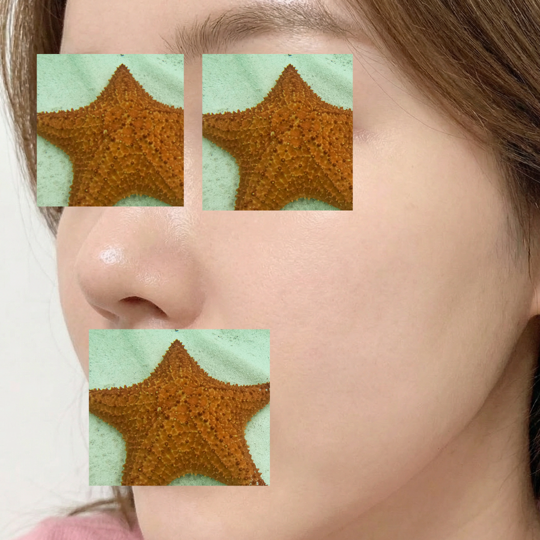 수술후기이미지