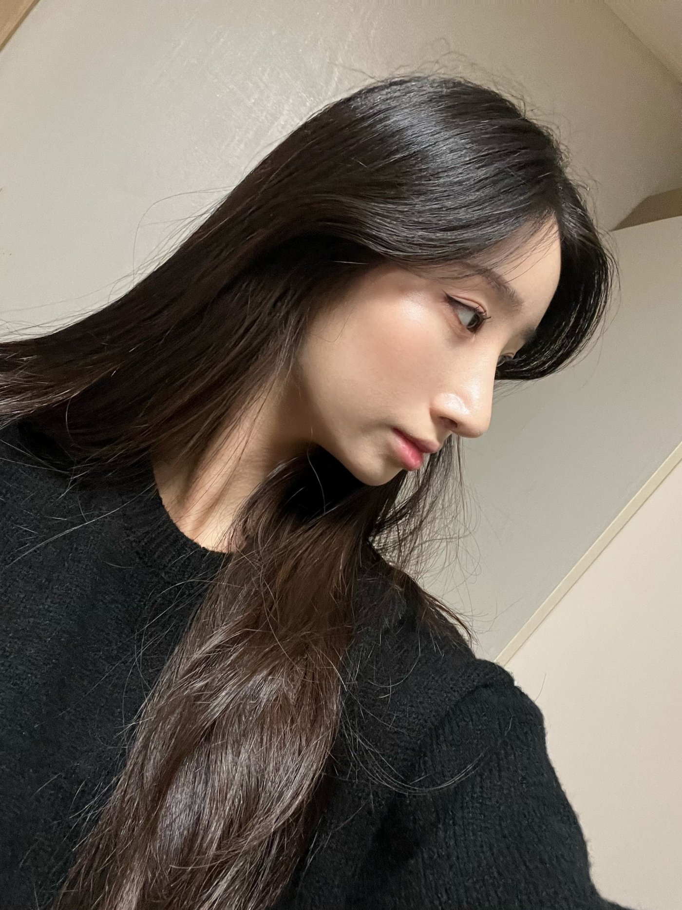 수술후기이미지