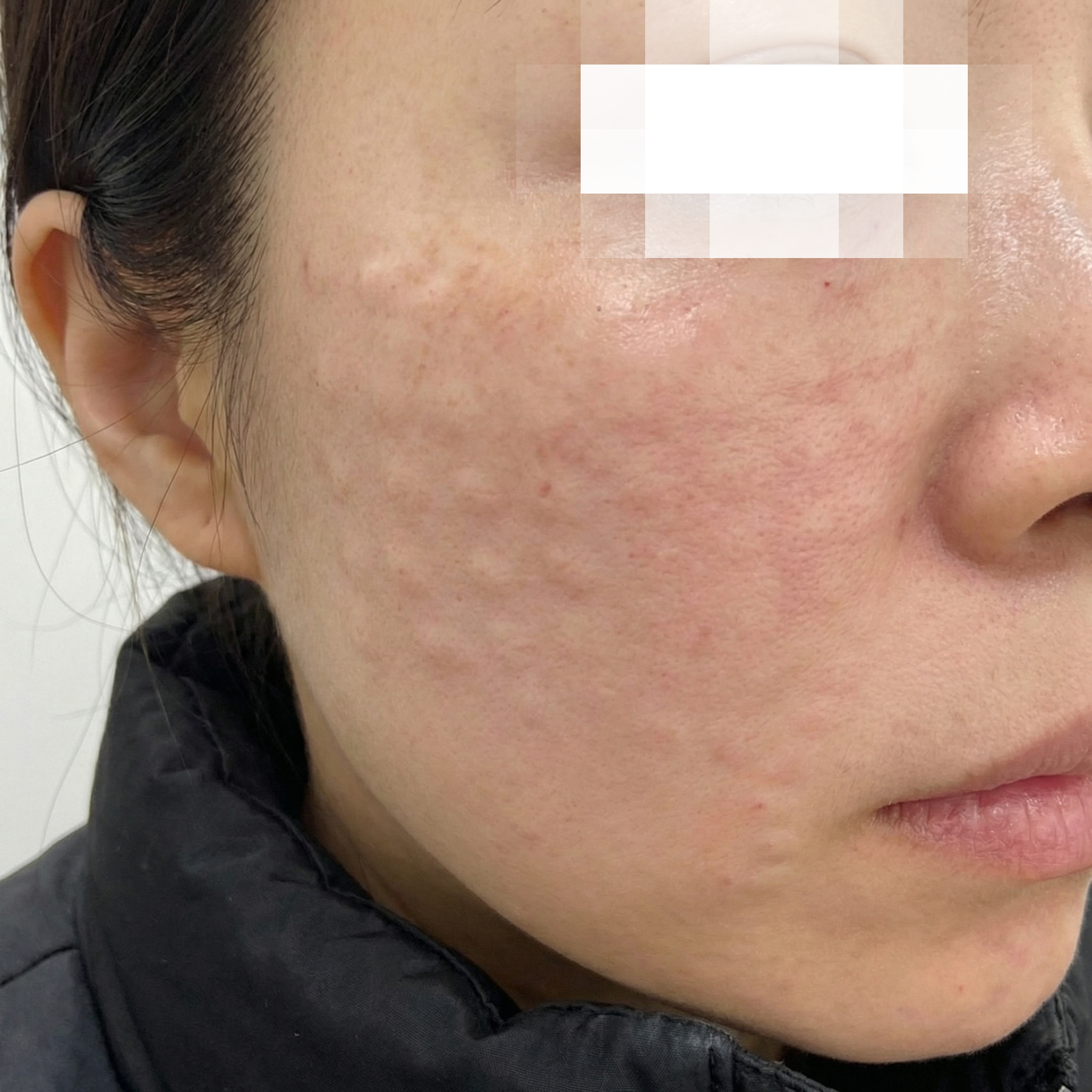 수술후기이미지