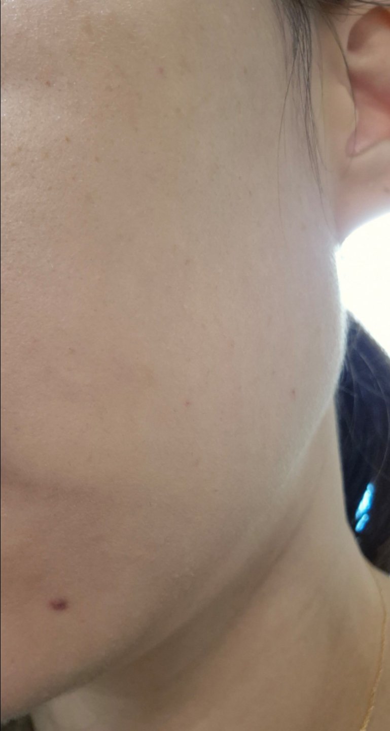 수술후기이미지