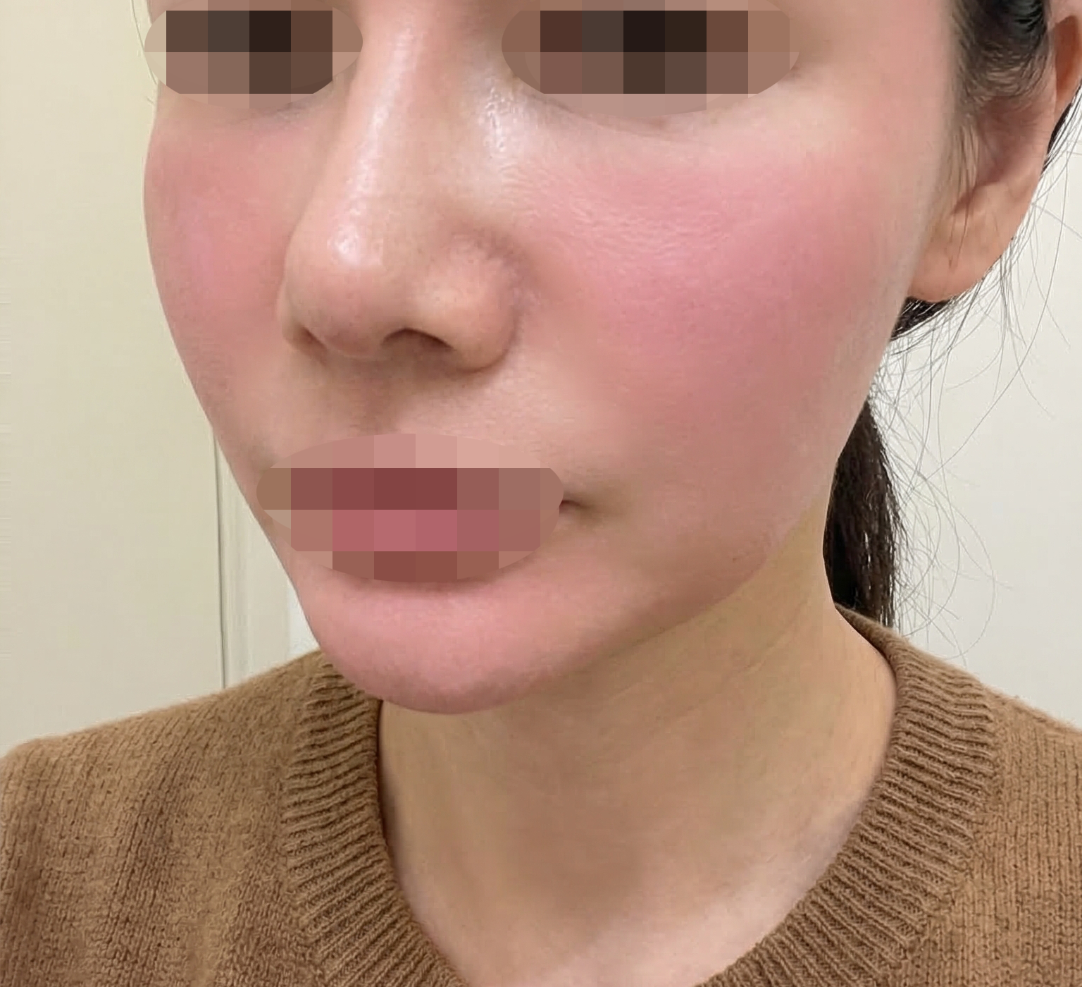 수술후기이미지