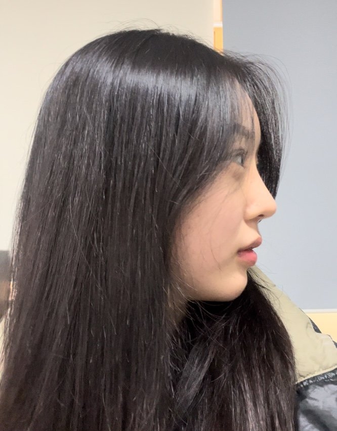 수술후기이미지