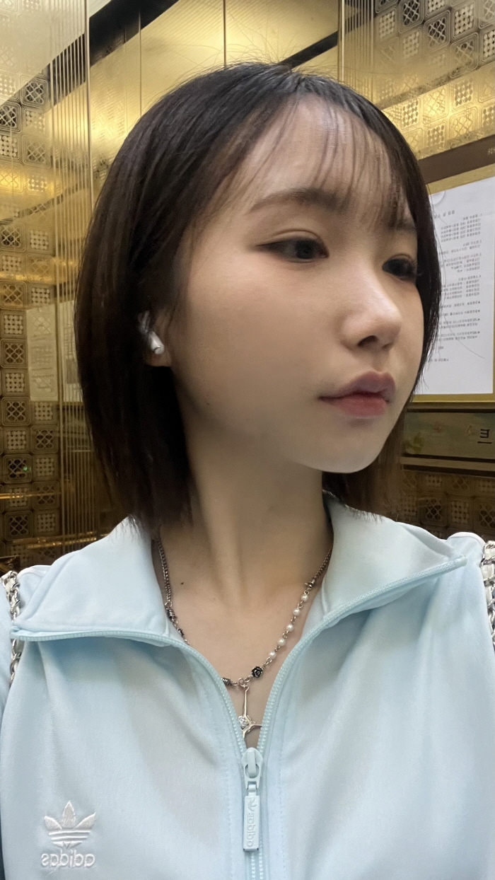 수술후기이미지