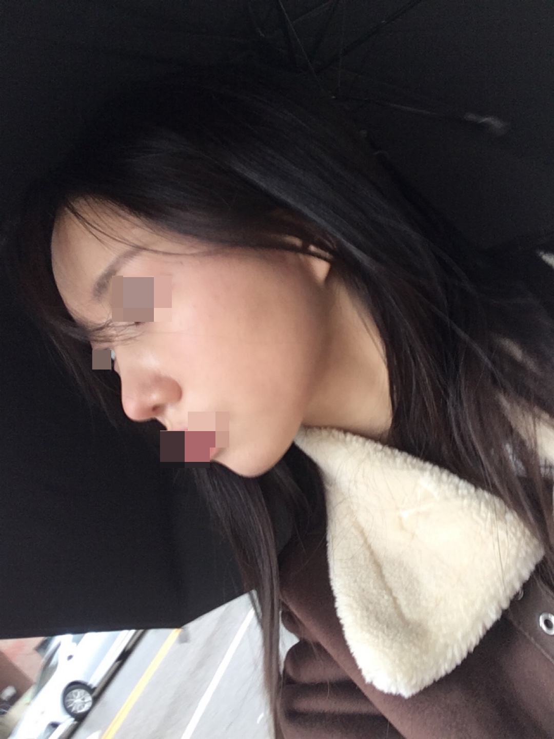 수술후기이미지