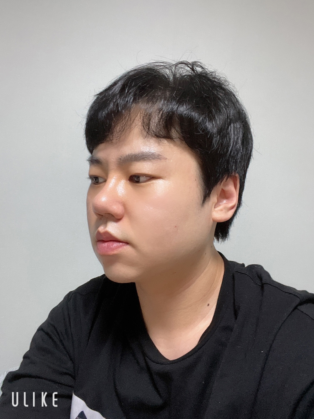 수술후기이미지