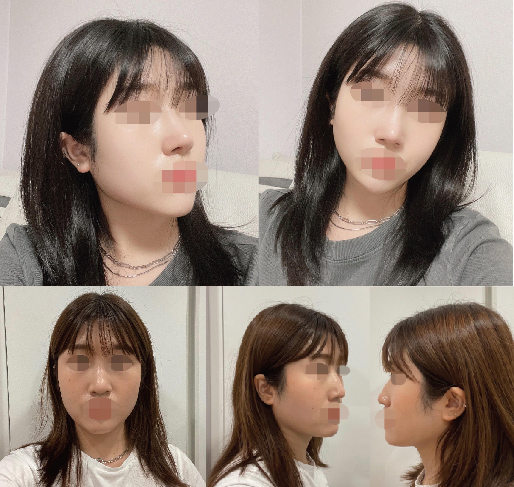 수술후기이미지