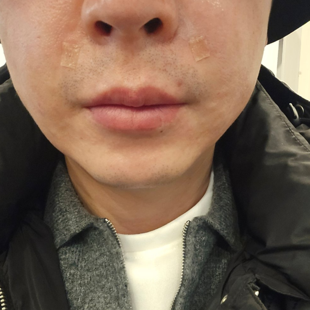 수술후기이미지