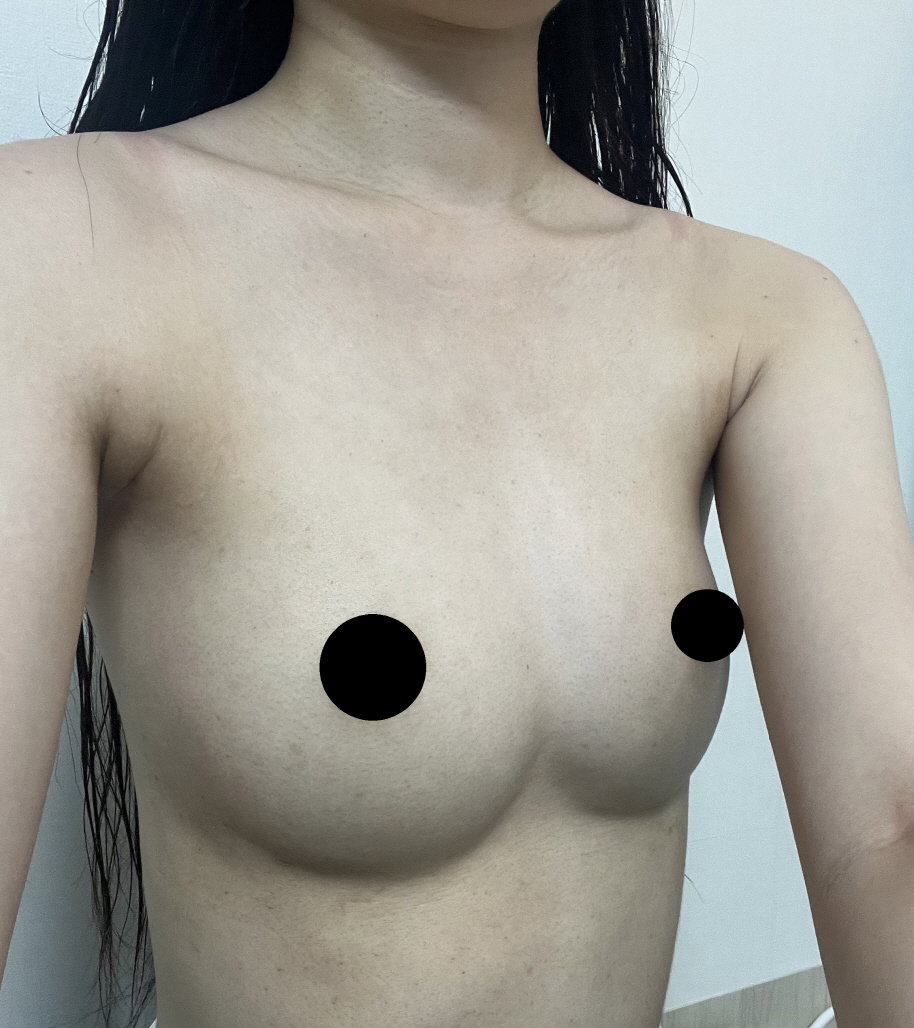 수술후기이미지