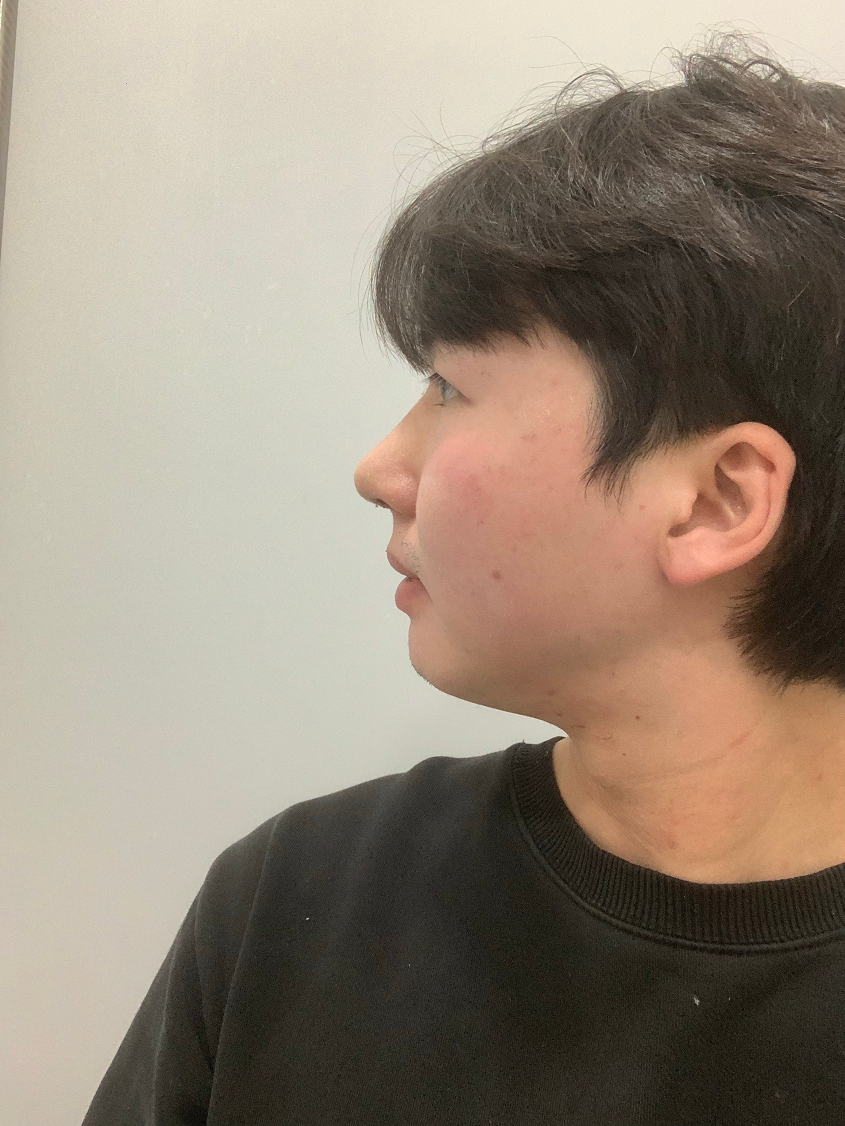 수술후기이미지