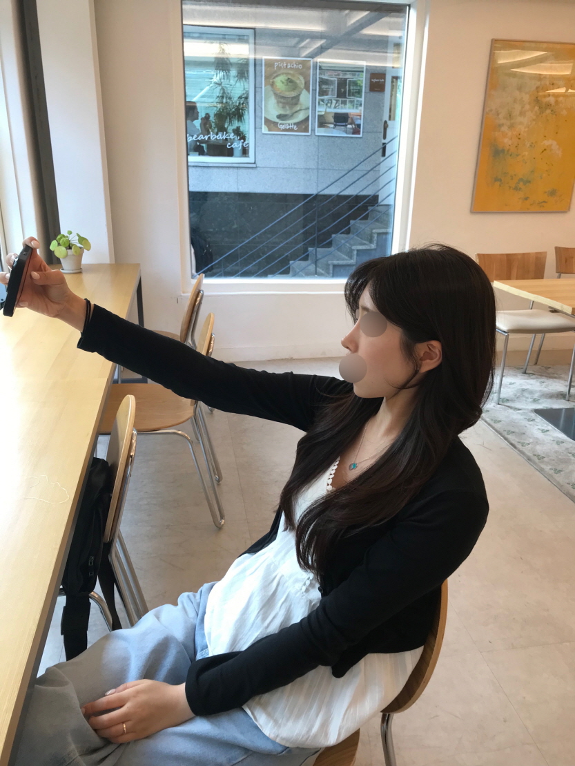 수술후기이미지