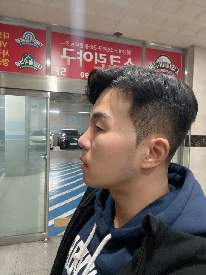 수술후기이미지