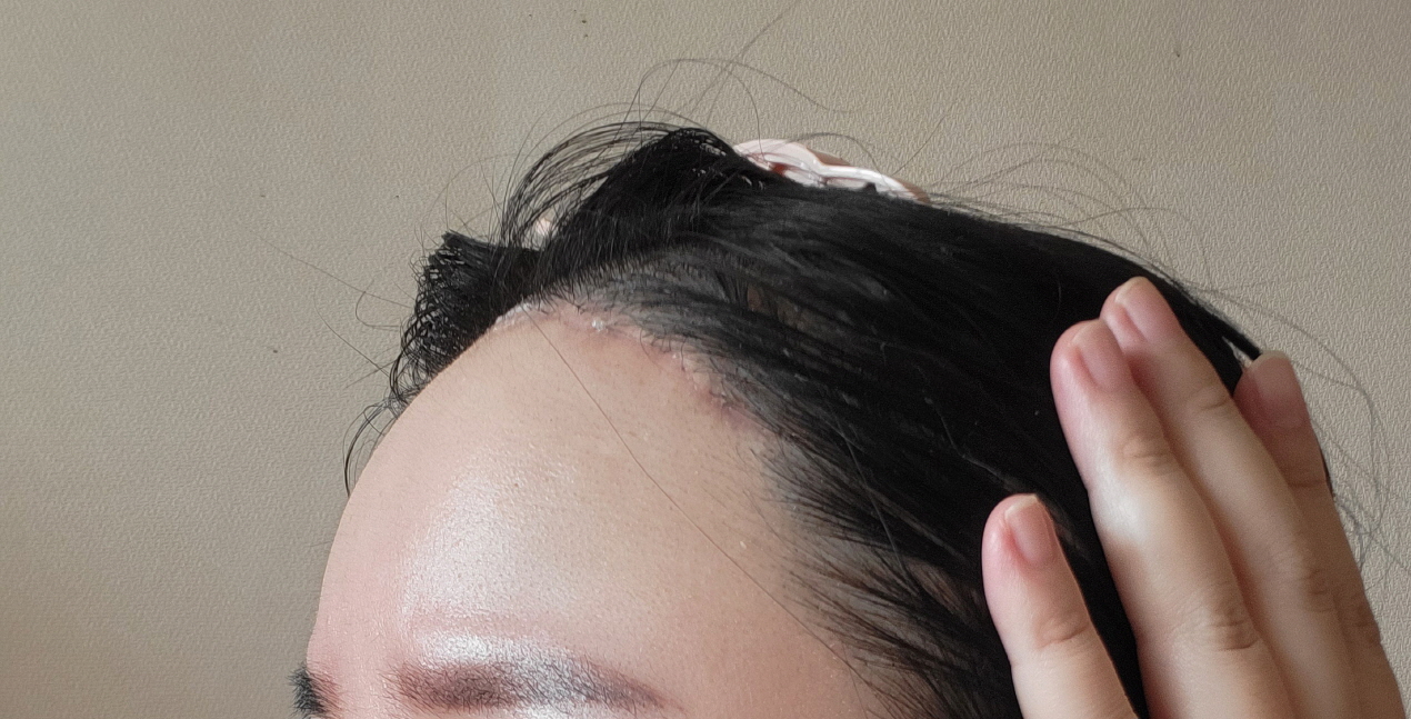 수술후기이미지