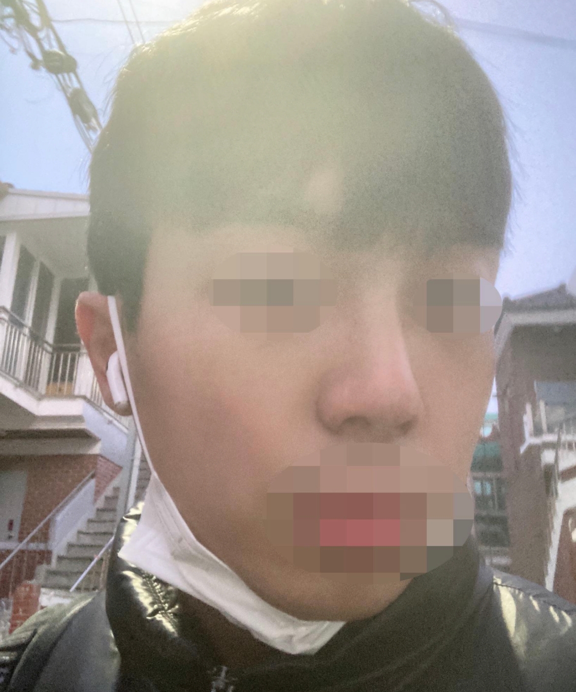 수술후기이미지