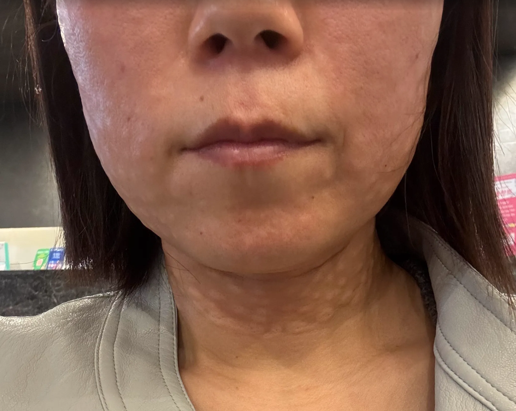 수술후기이미지