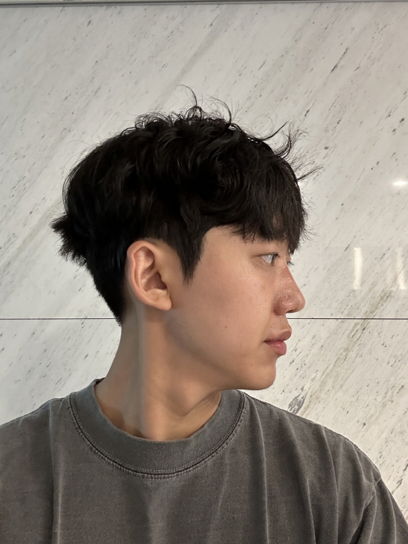 수술후기이미지