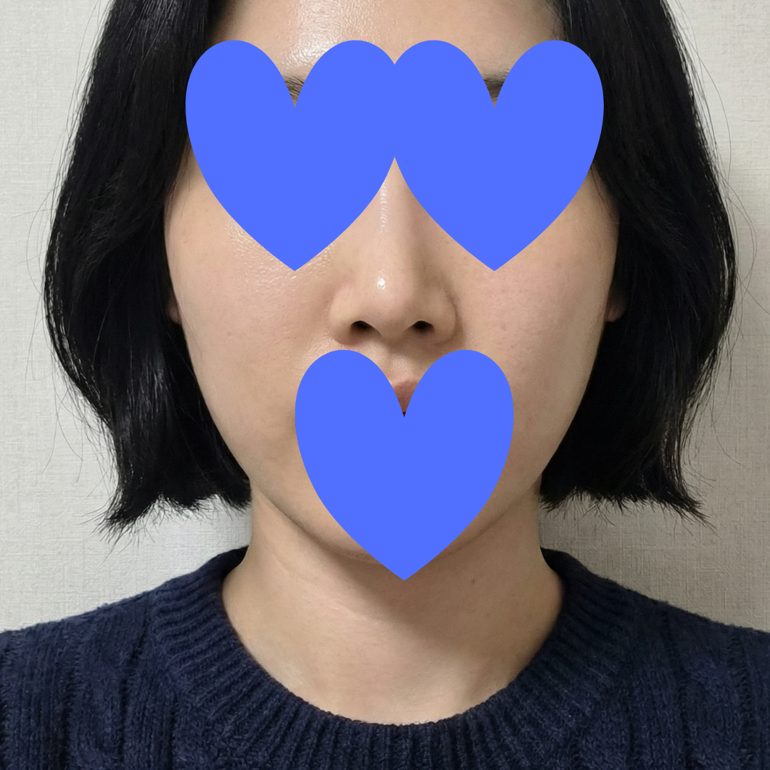 수술후기이미지