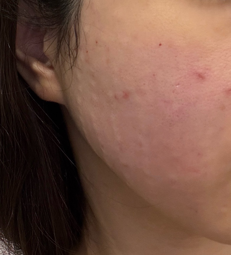 수술후기이미지