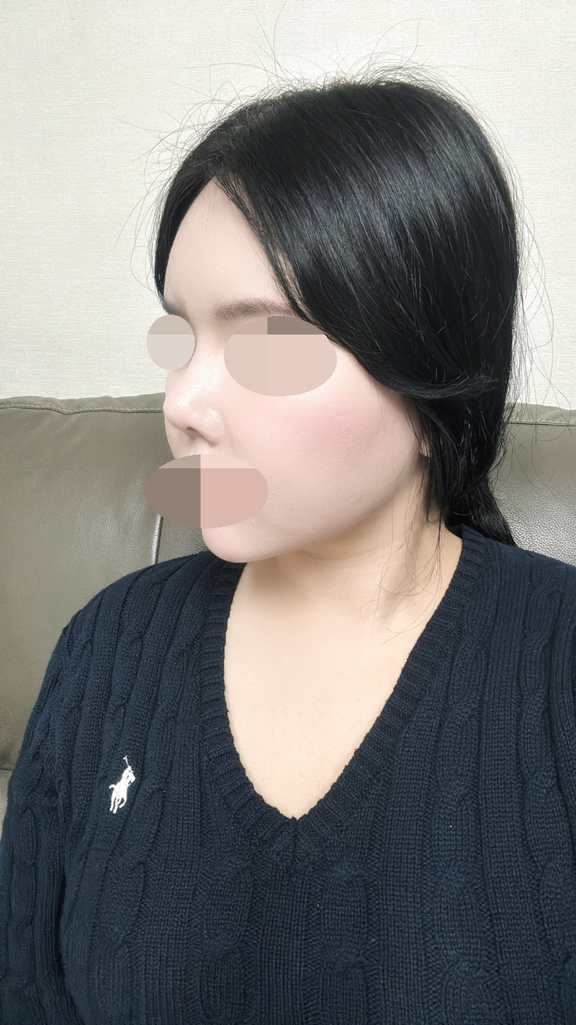 수술후기이미지