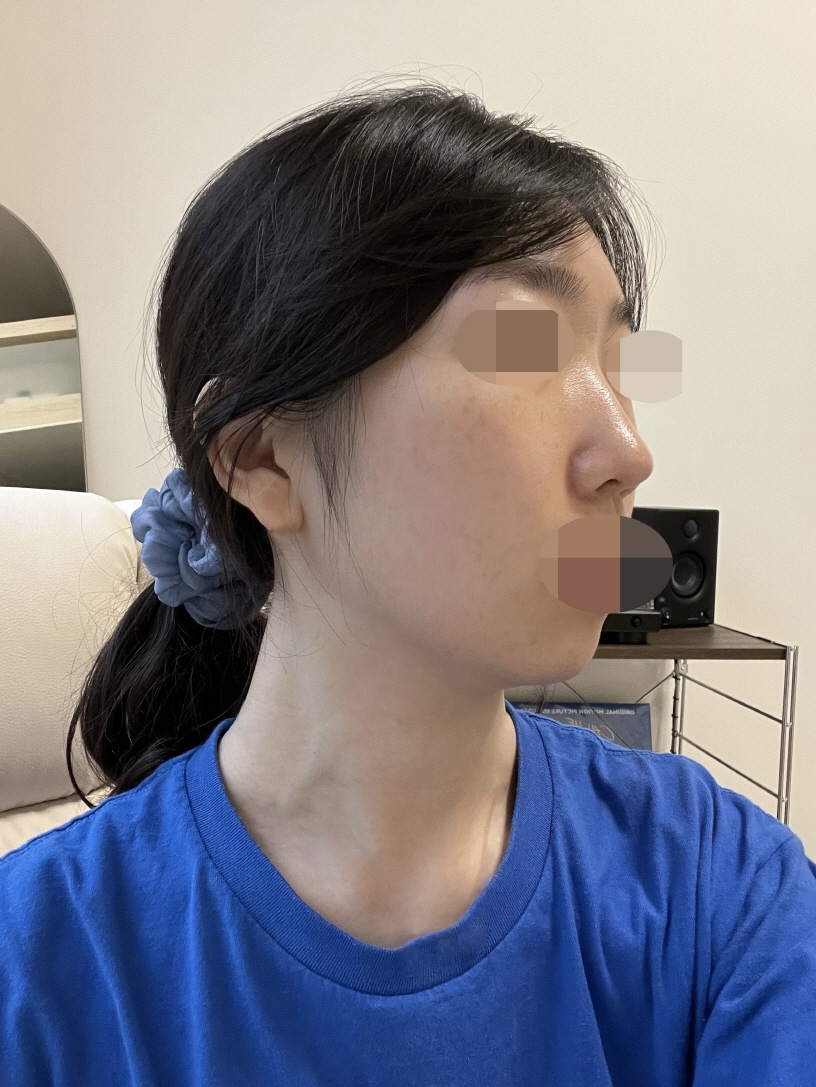 수술후기이미지