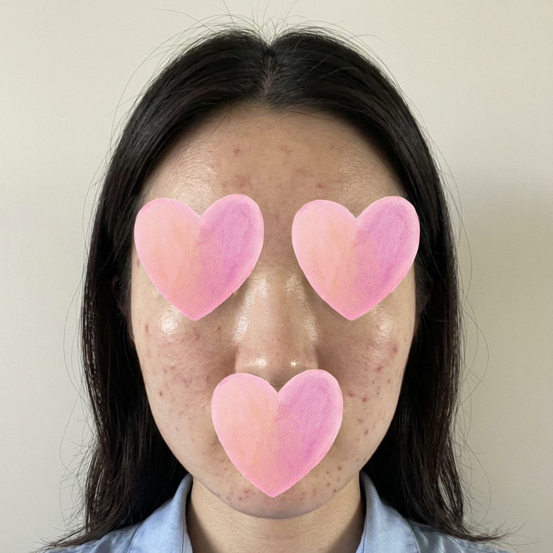 수술후기이미지