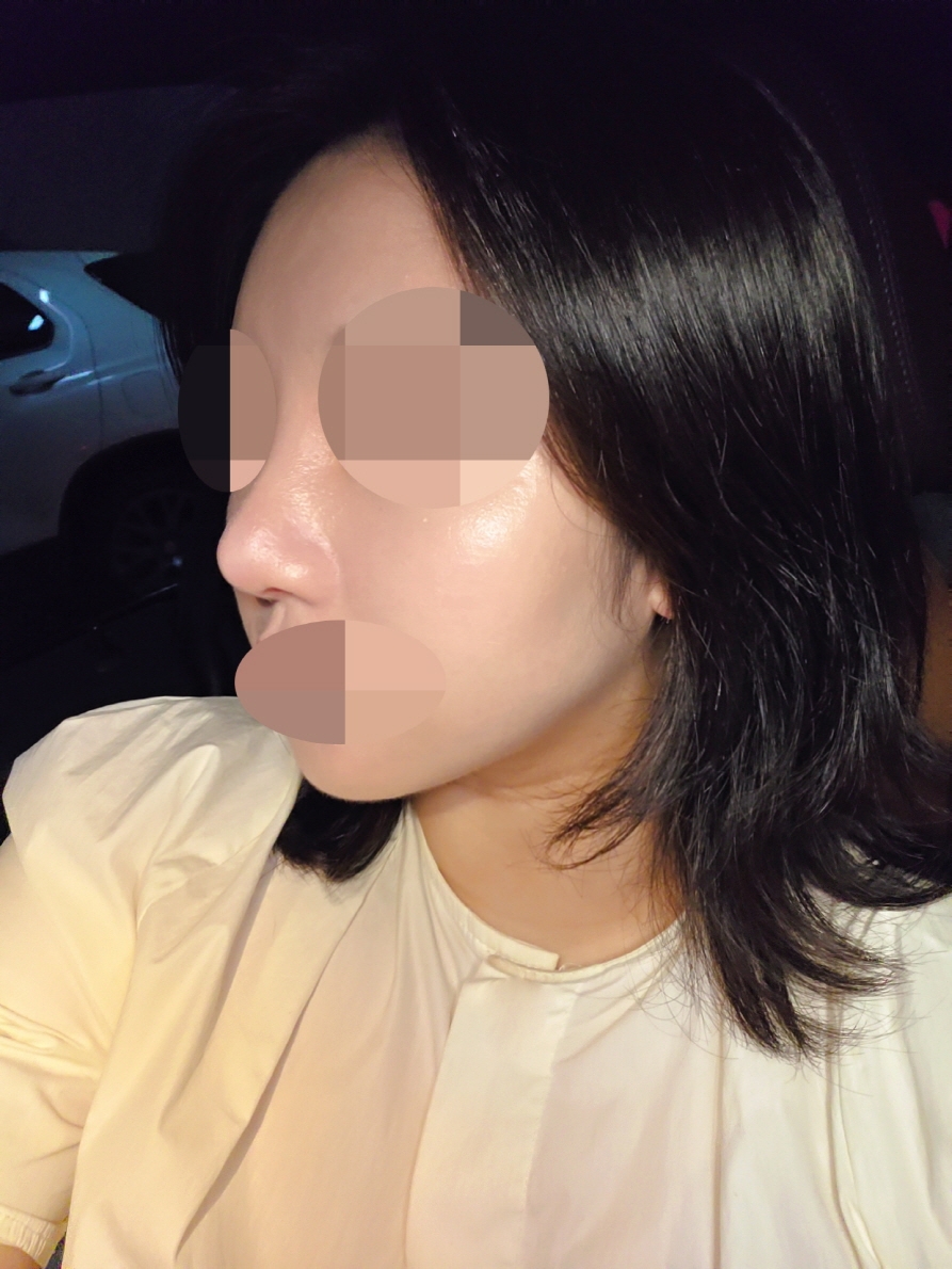 수술후기이미지