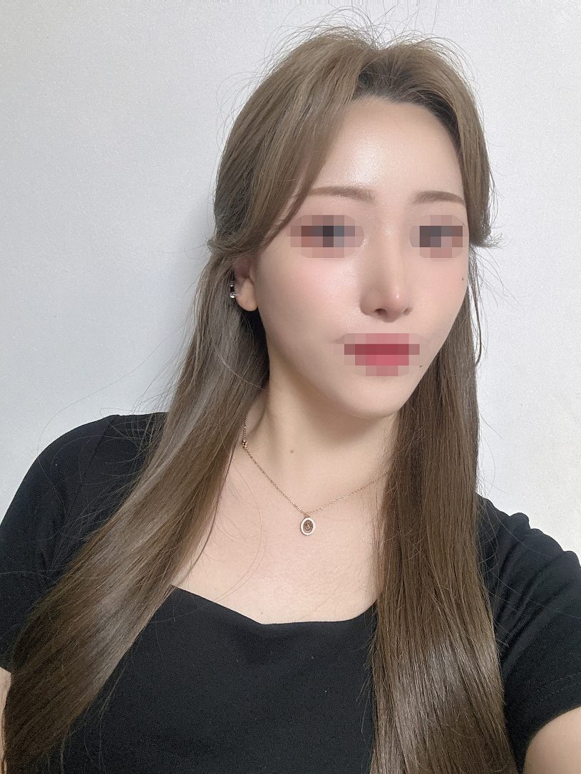 수술후기이미지