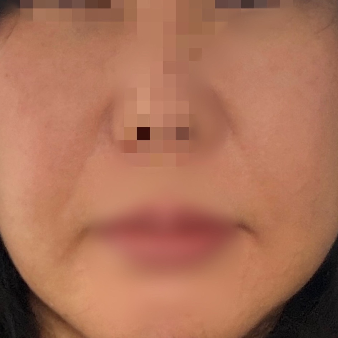 수술후기이미지