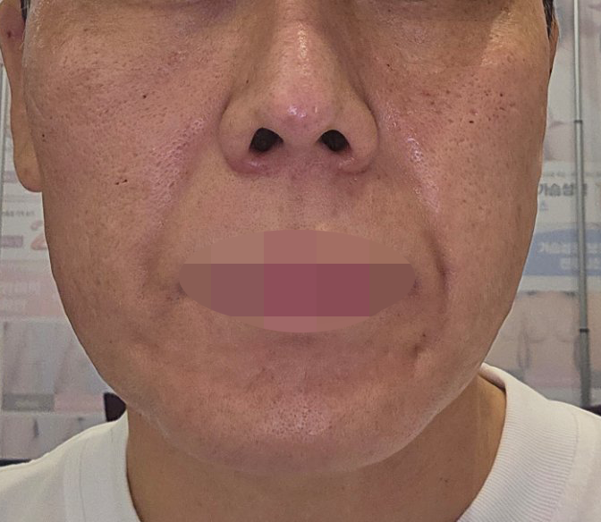 수술후기이미지