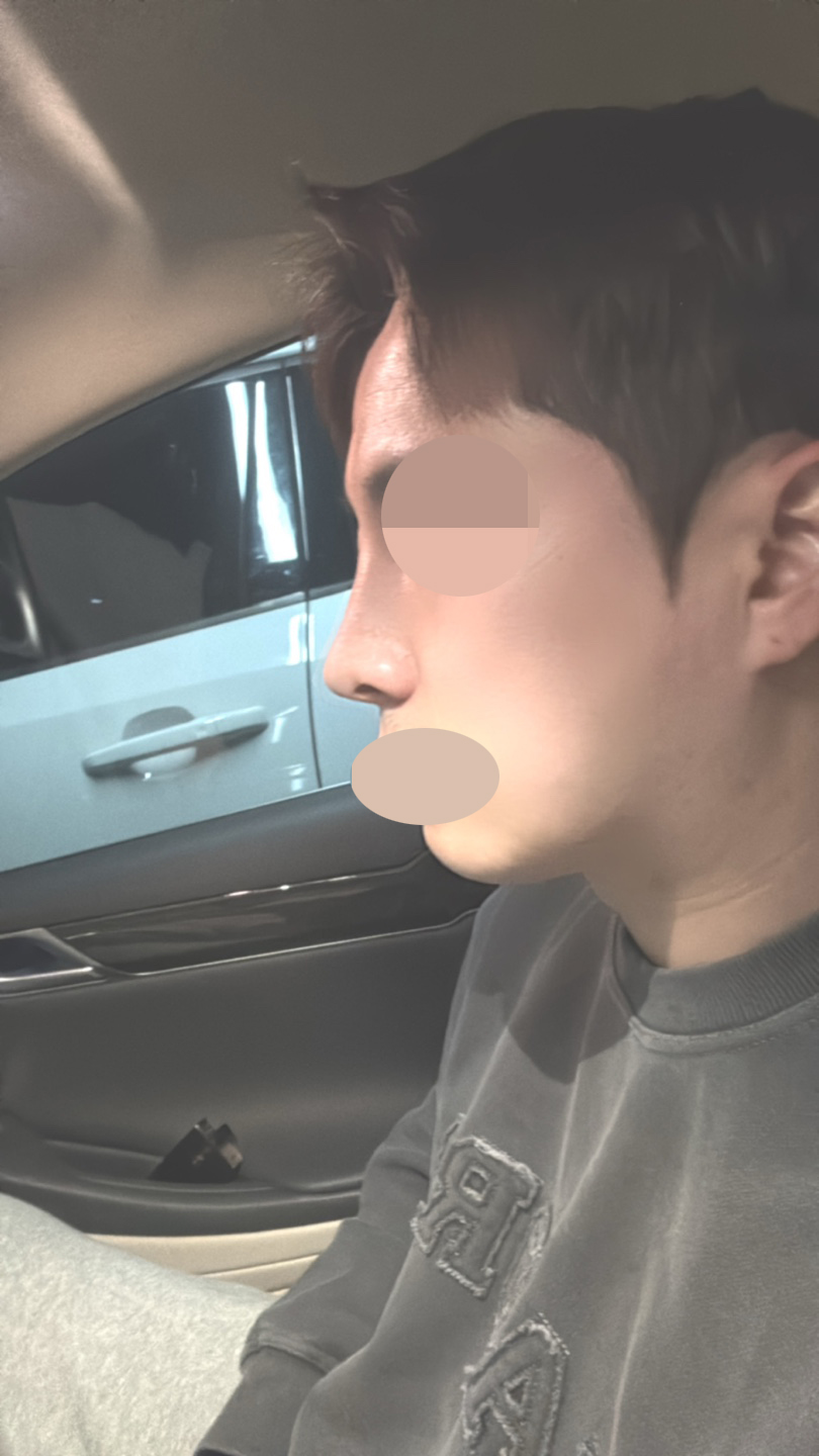 수술후기이미지