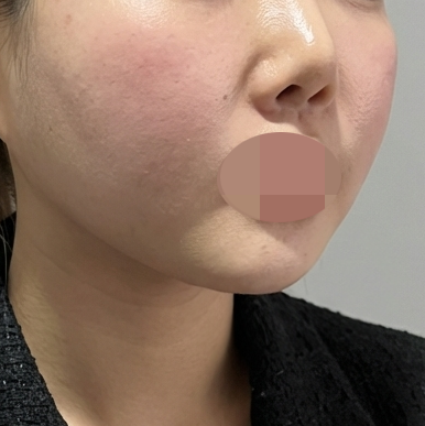 수술후기이미지