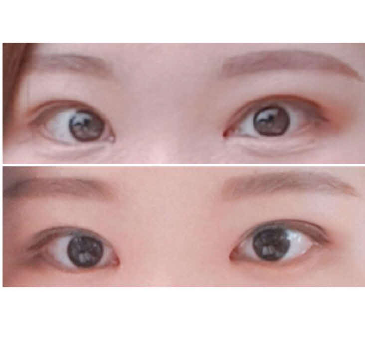 수술후기이미지