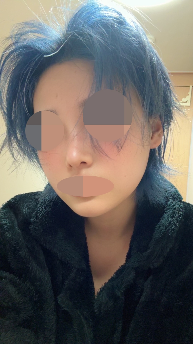 수술후기이미지