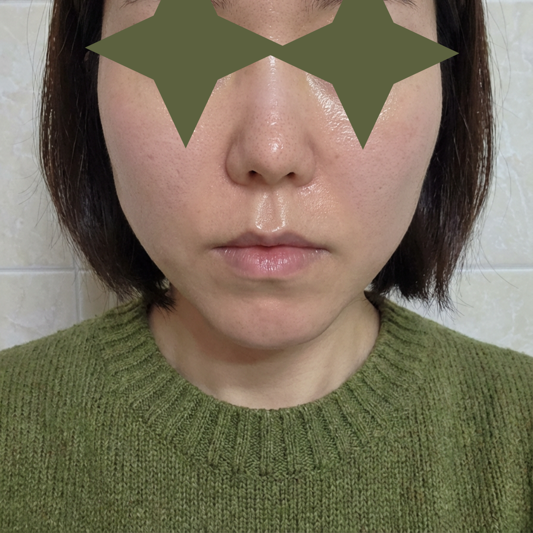 수술후기이미지