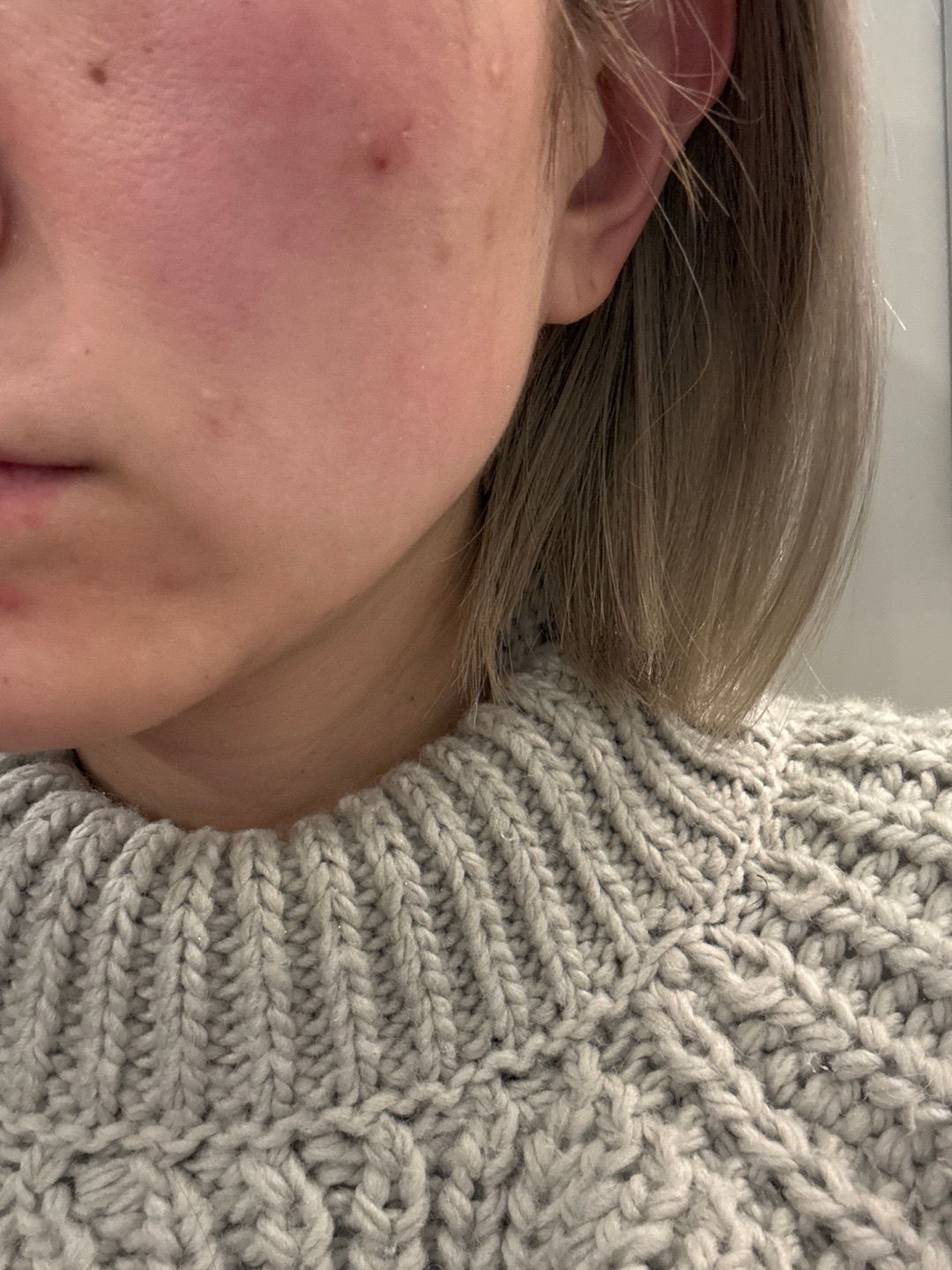 수술후기이미지