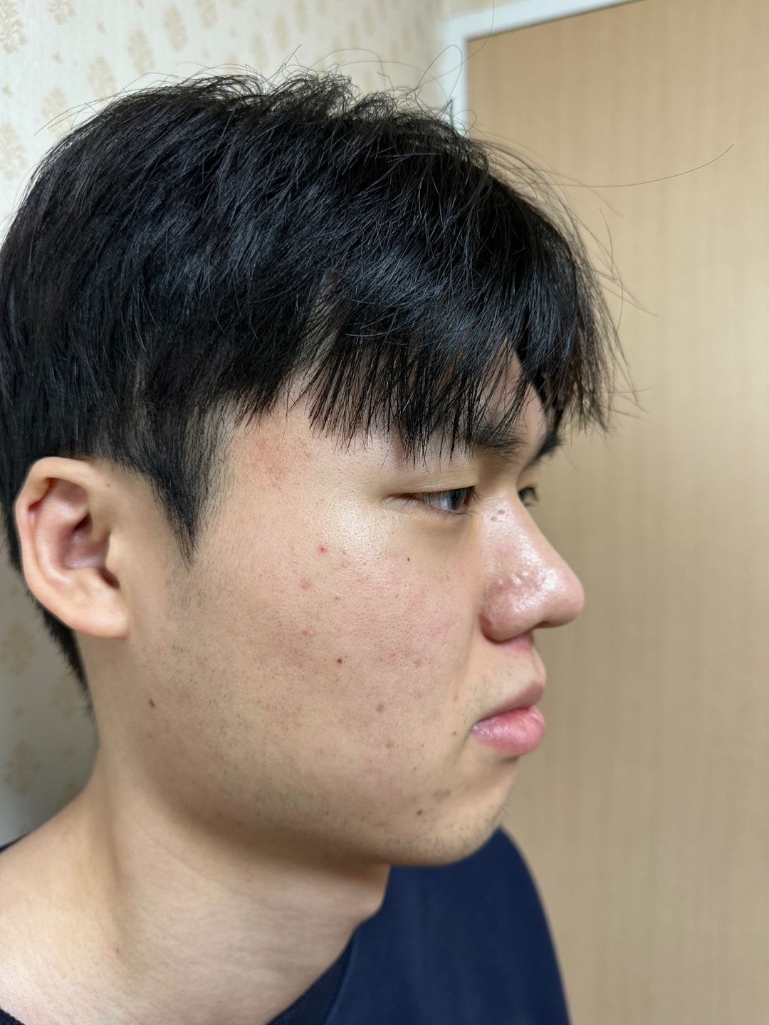 수술후기이미지