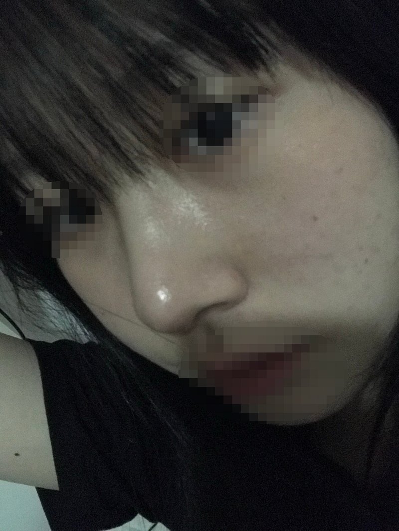 수술후기이미지