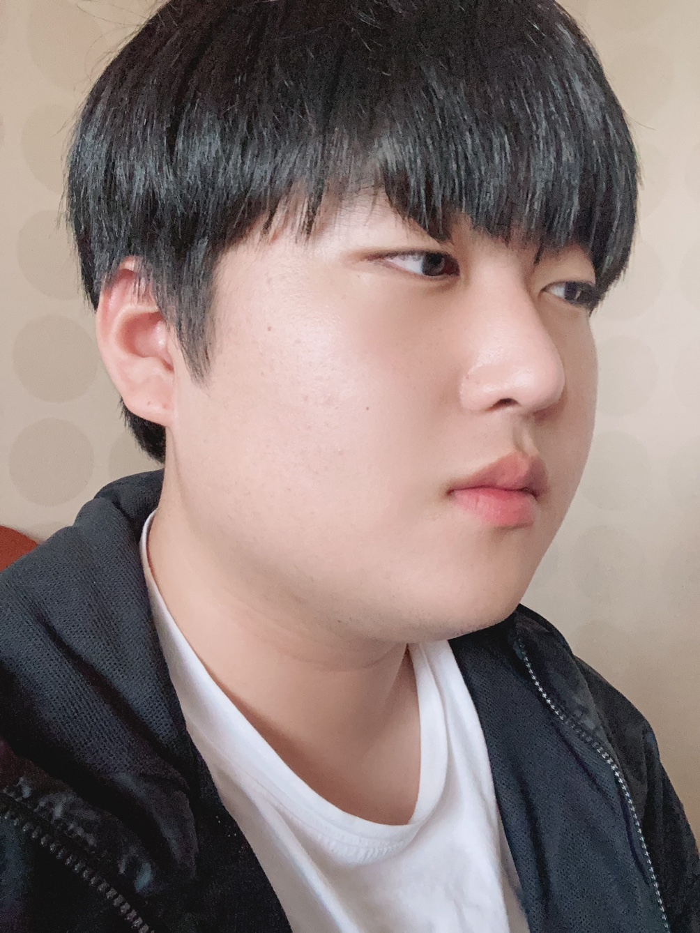 수술후기이미지