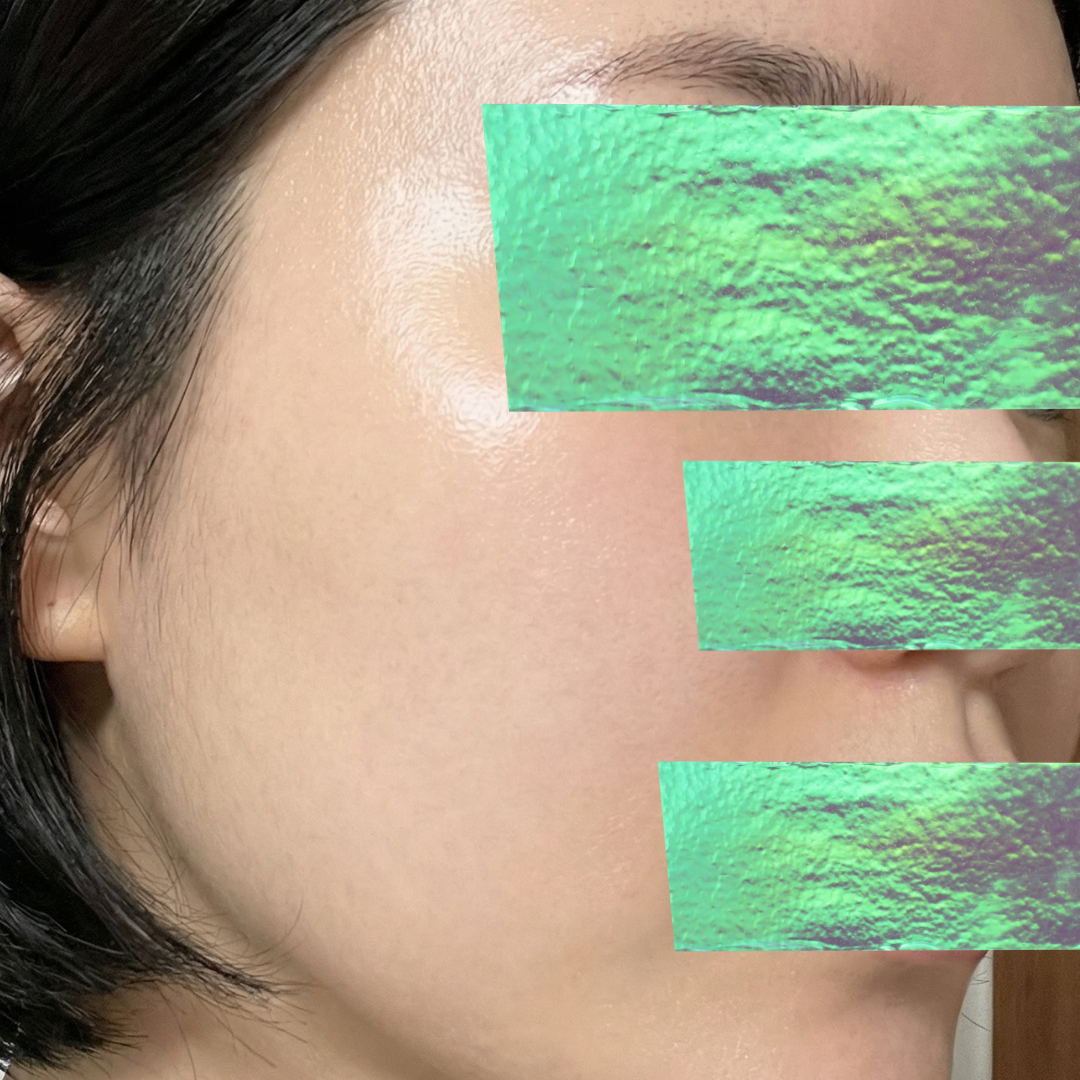 수술후기이미지