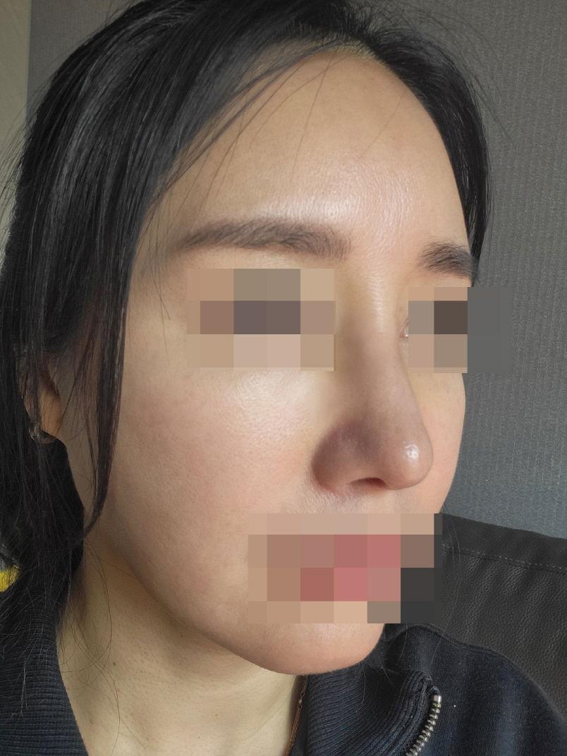 수술후기이미지