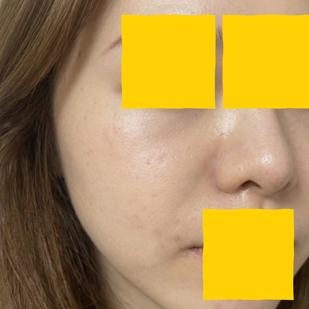 수술후기이미지