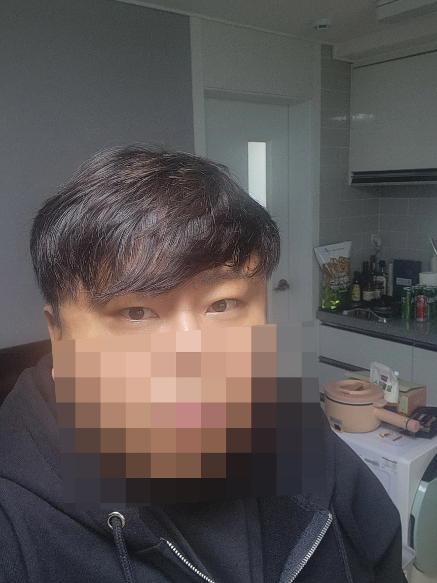 수술후기이미지