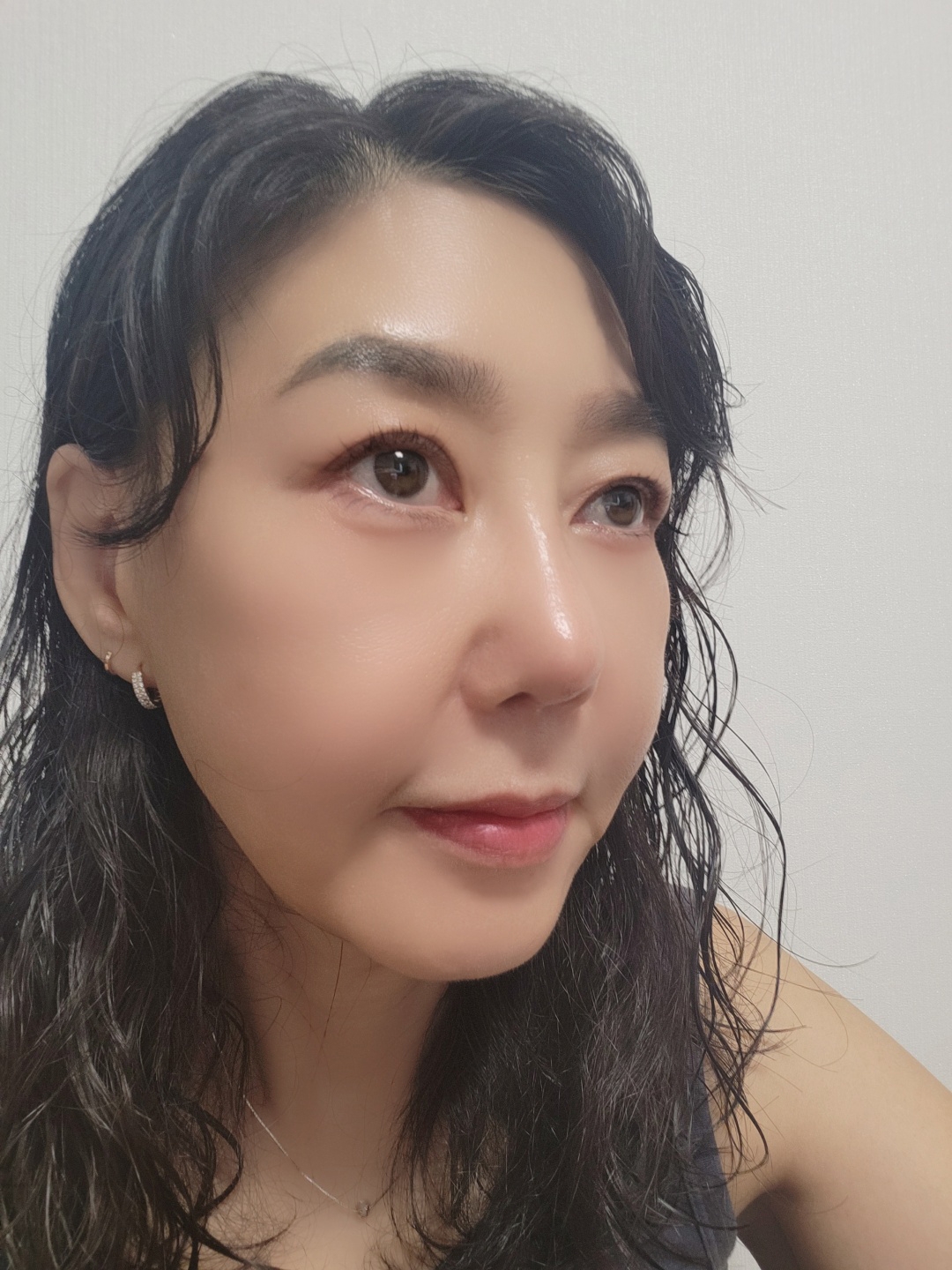 수술후기이미지