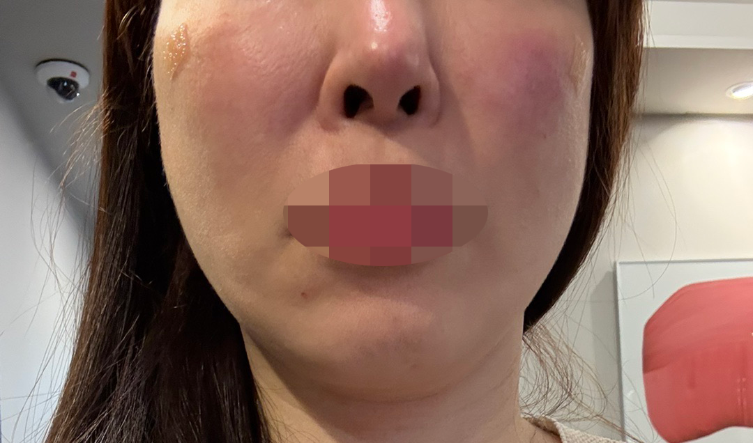 수술후기이미지