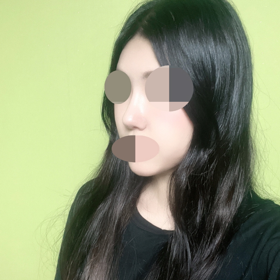 수술후기이미지