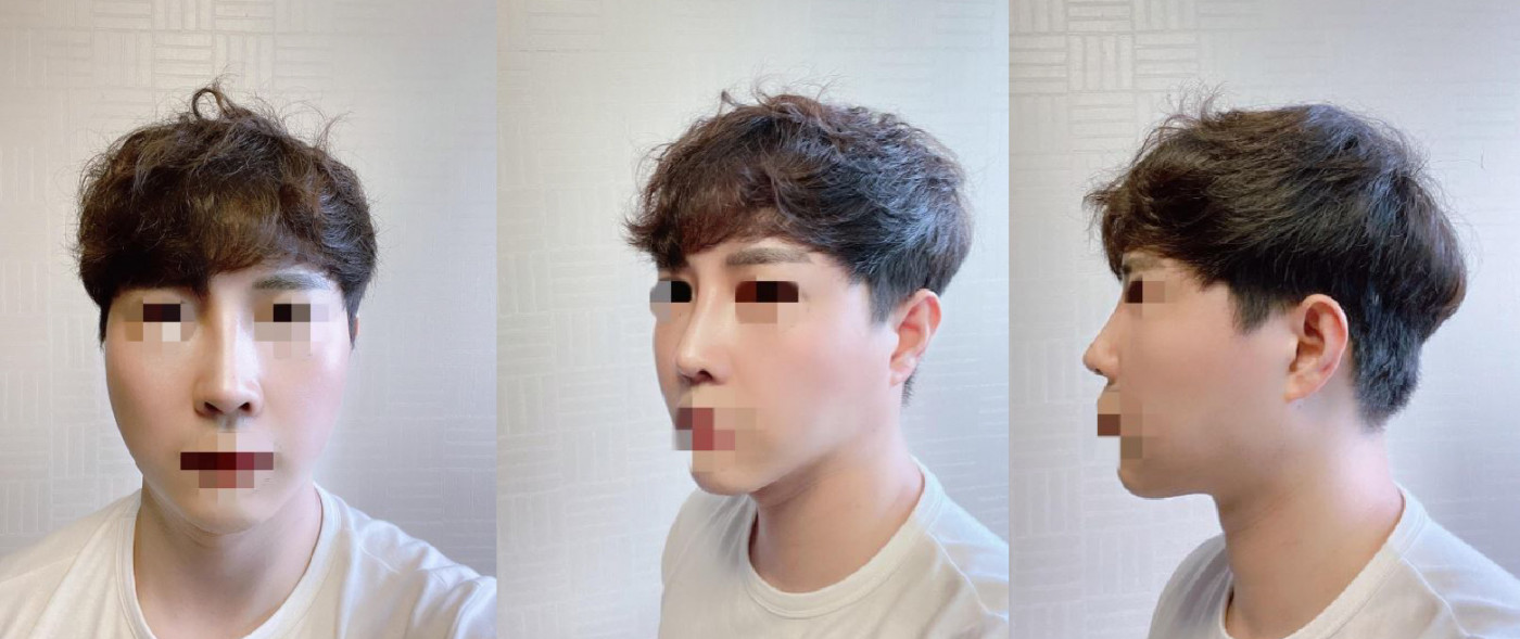 수술후기이미지