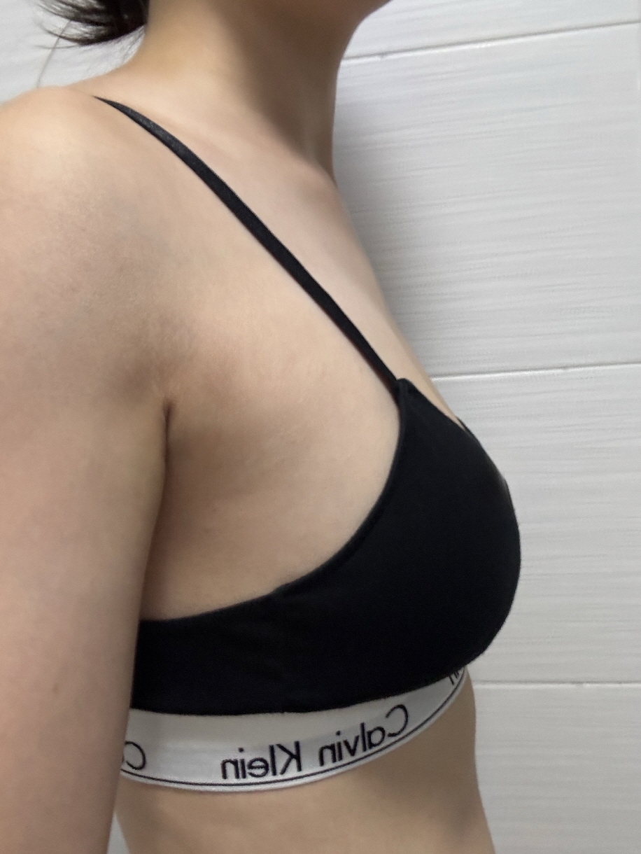 수술후기이미지