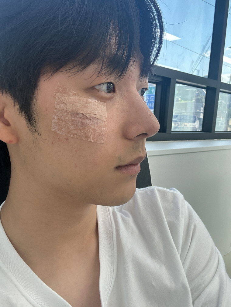 수술후기이미지