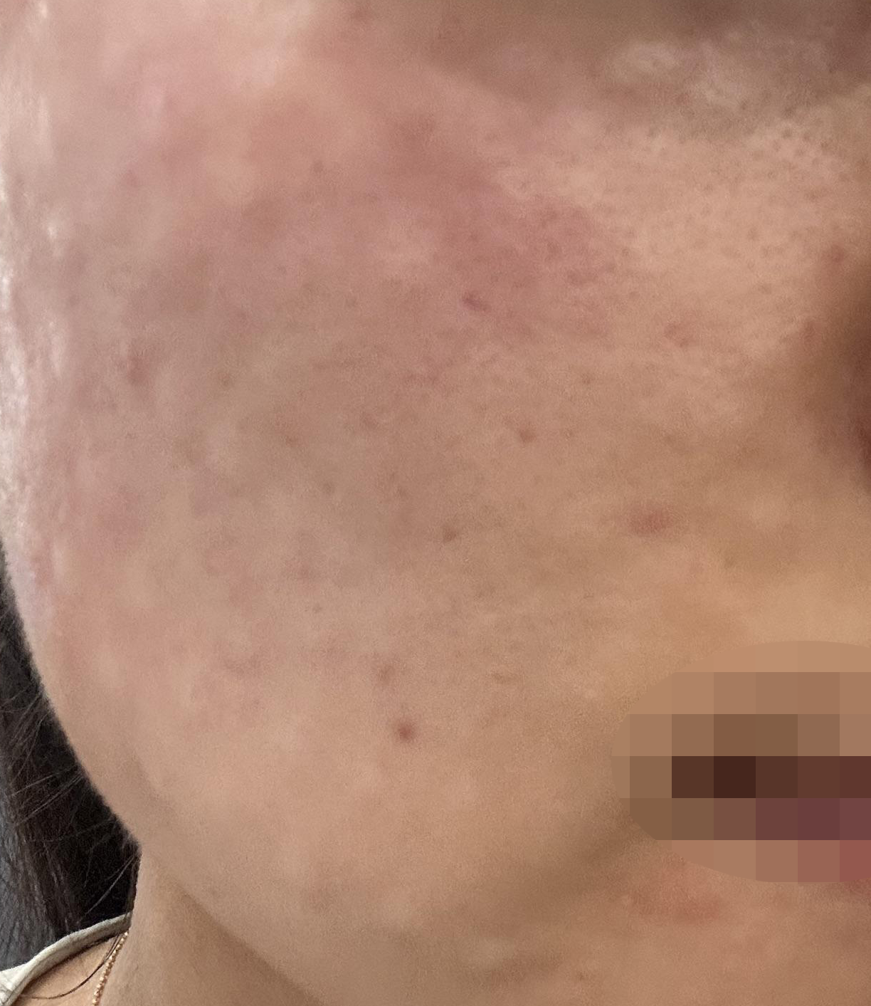 수술후기이미지