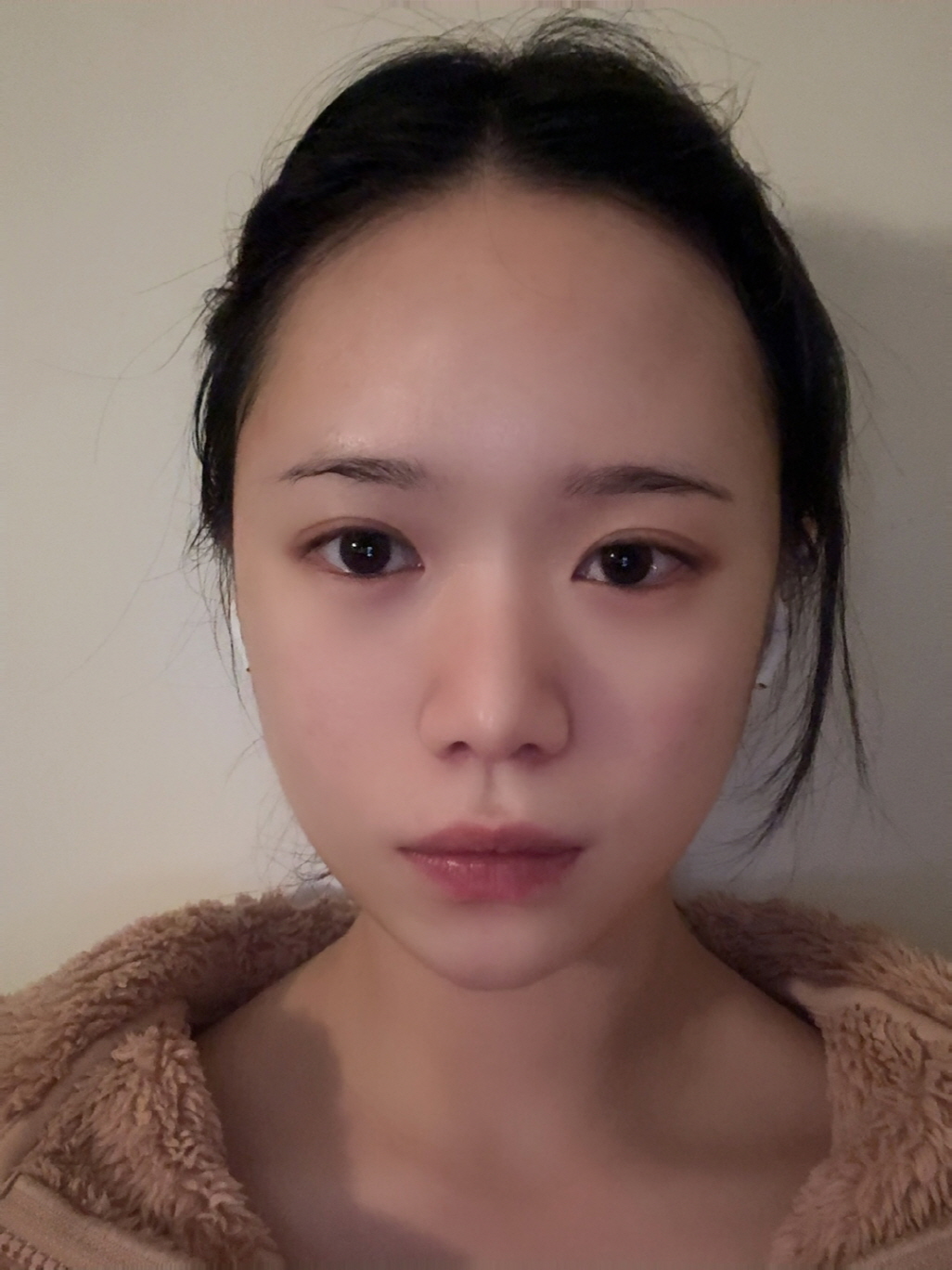 수술후기이미지